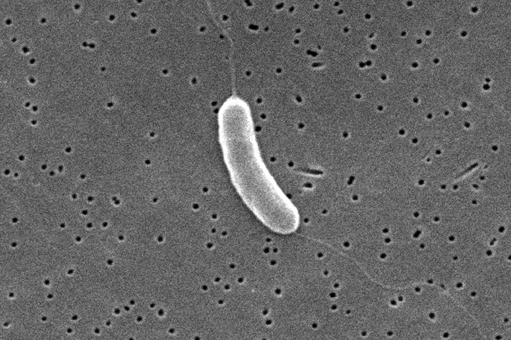 Alerta sanitaria en Long Island por hallazgo de bacteria “comecarne” en sus aguas